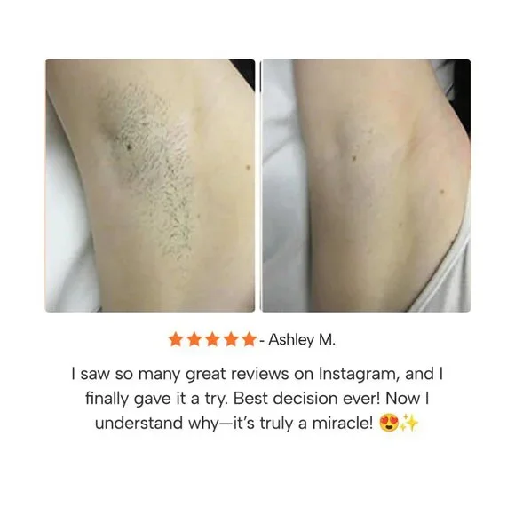 EPIFY - Picture 4 of 15